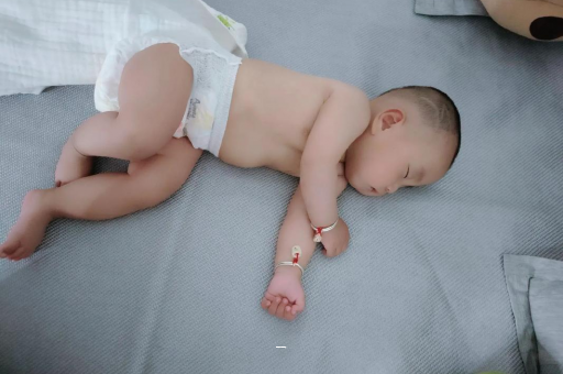 海口宝宝脸上有白色斑块